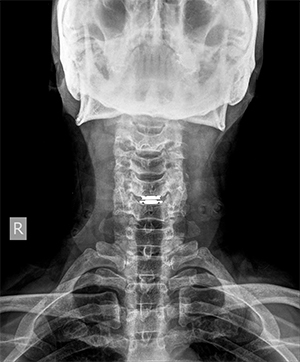 이미지명