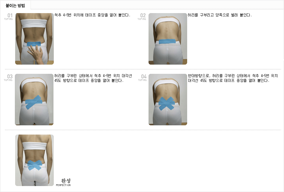 스타테이핑