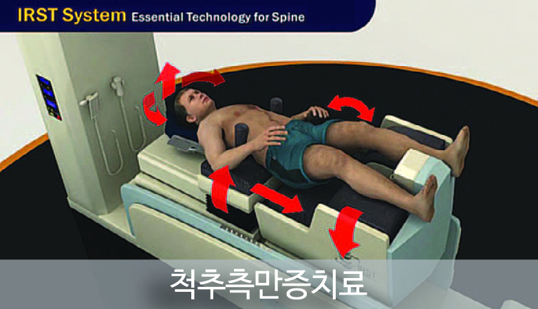 IRST의 적용대상 