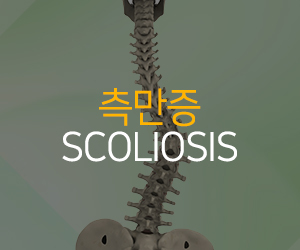 측만증