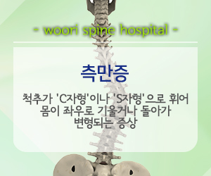 측만증