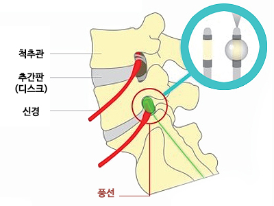 이미지명