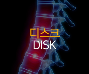 디스크