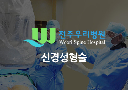 신경성형술