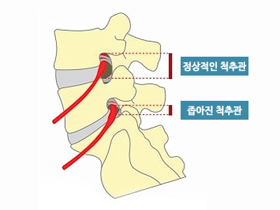이미지명