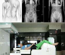 [DATANET] 전주 우리병원 "척추 측만증
