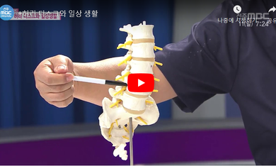 -+ 허리 디스크와 일상 생활