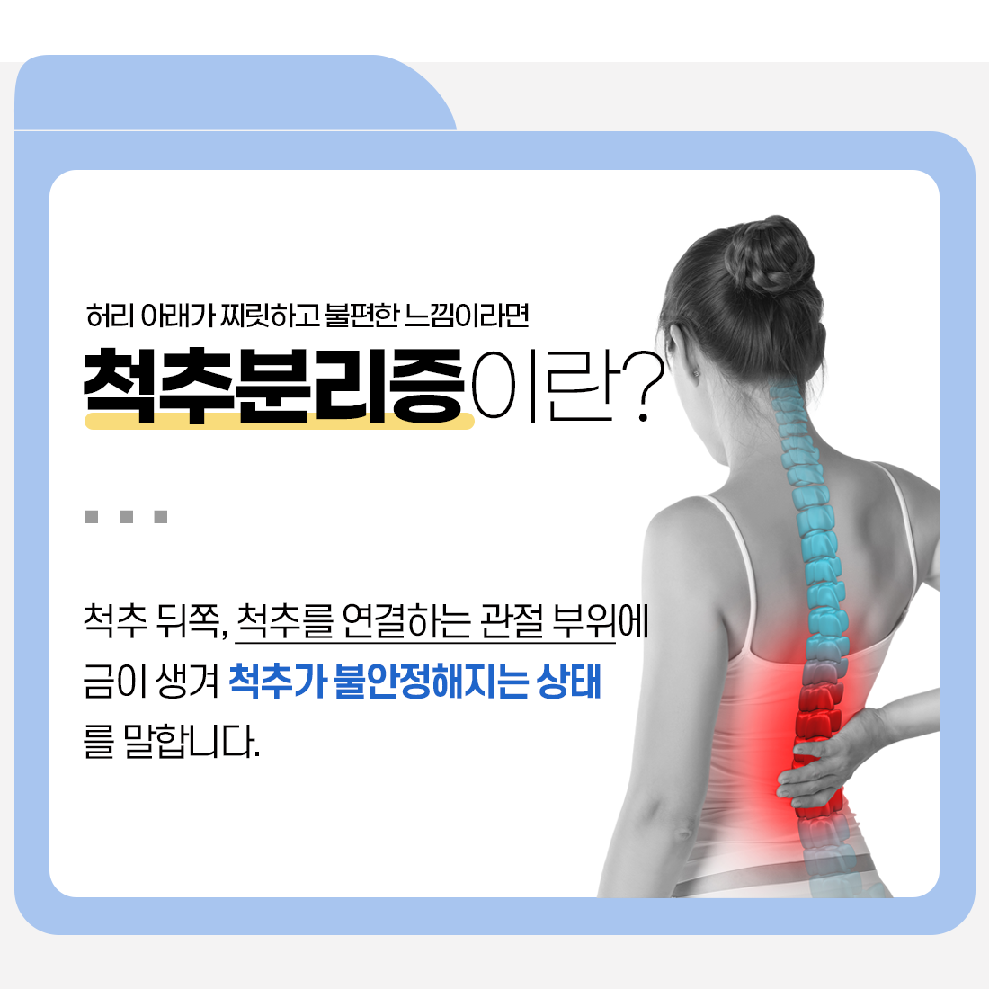 척추 분리증이란?