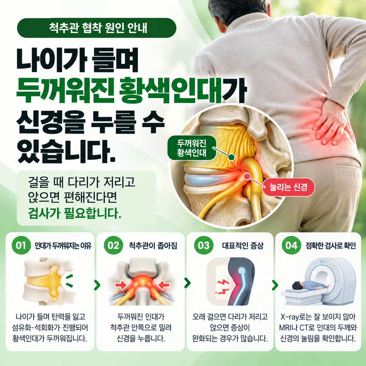 황색인대