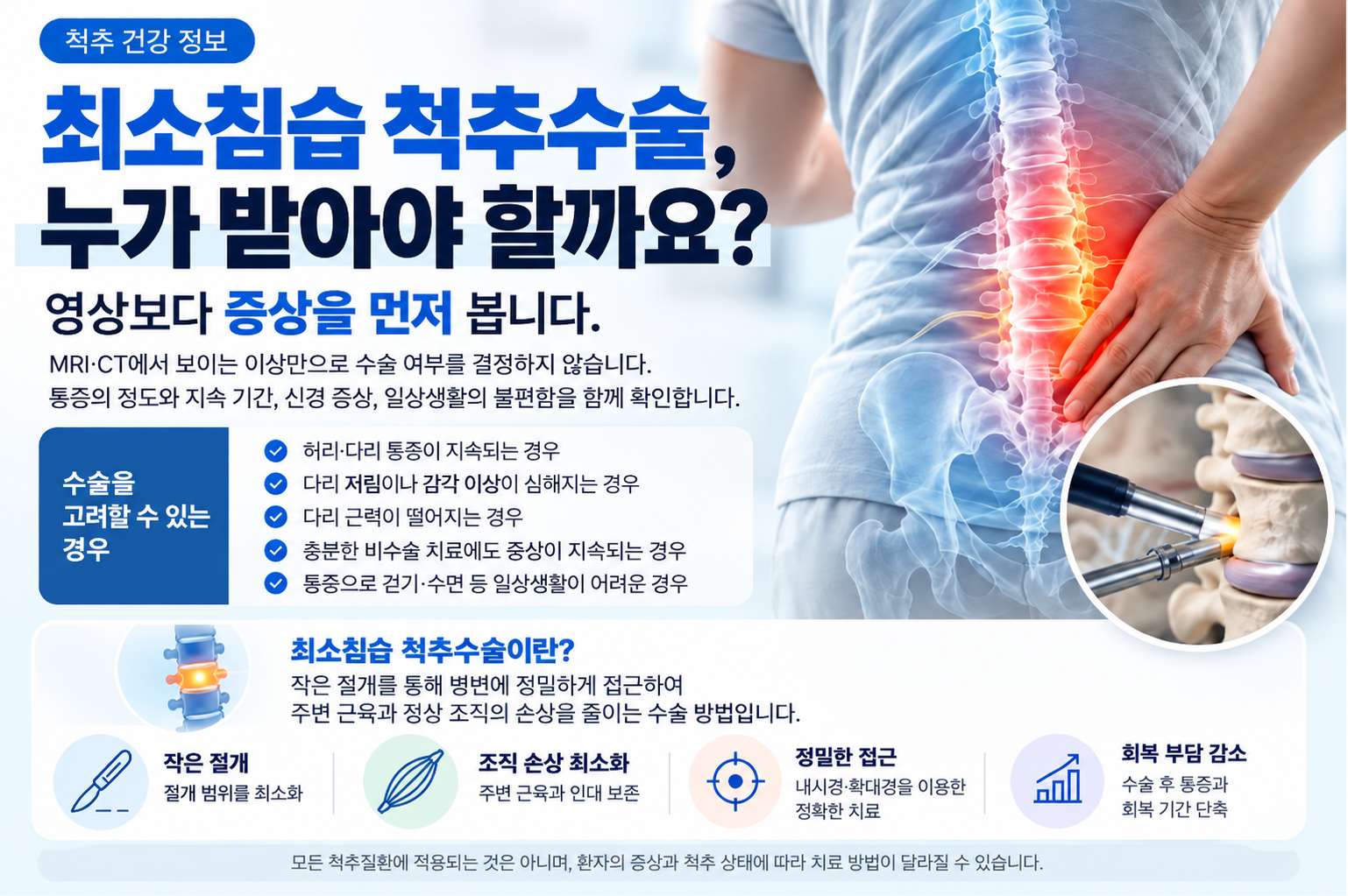최소침습