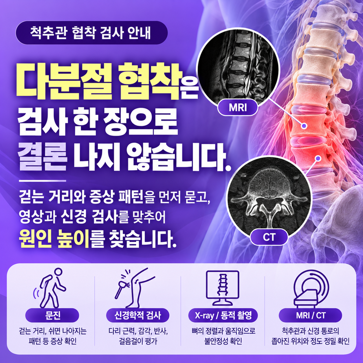 다분절협착
