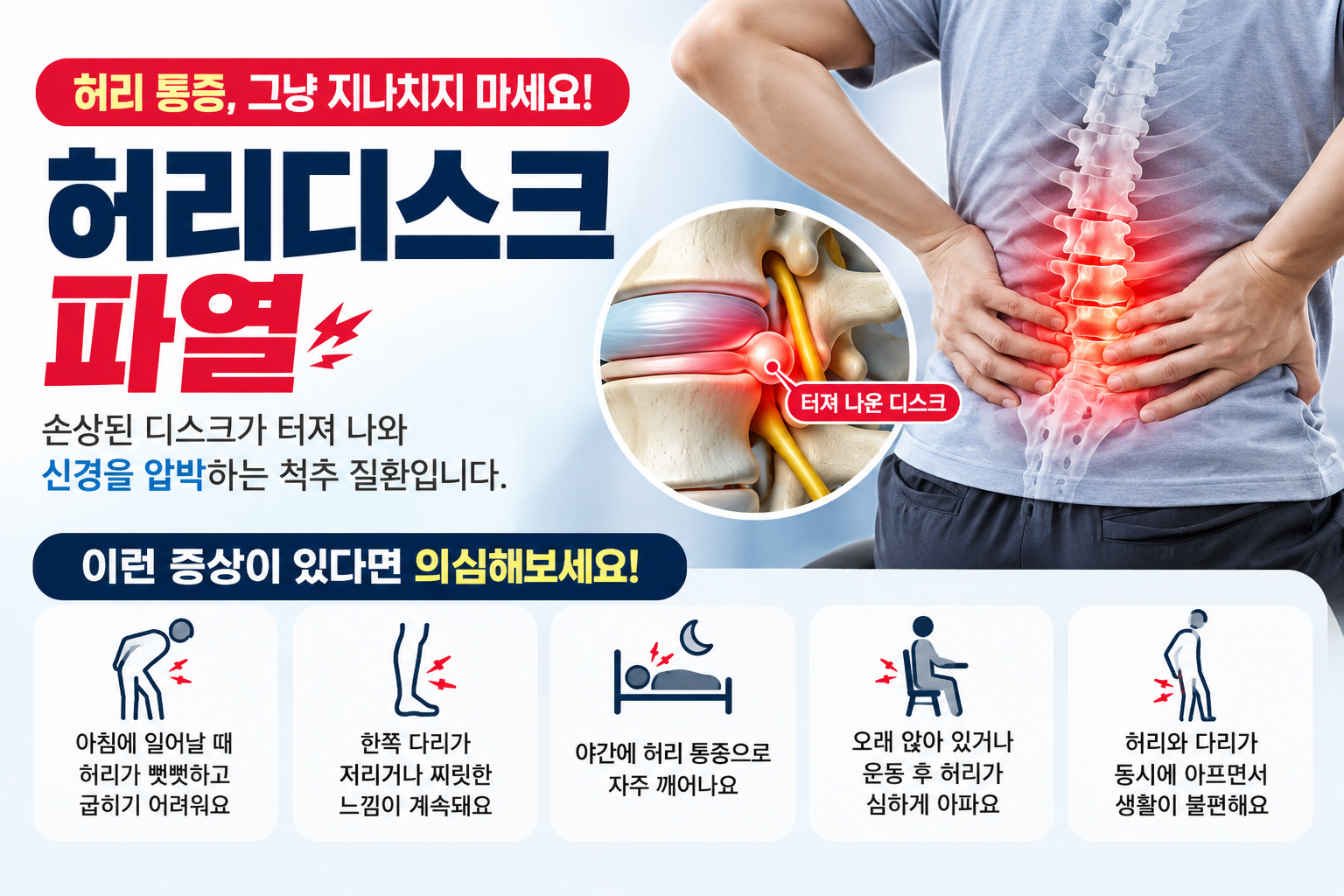 허리디스크