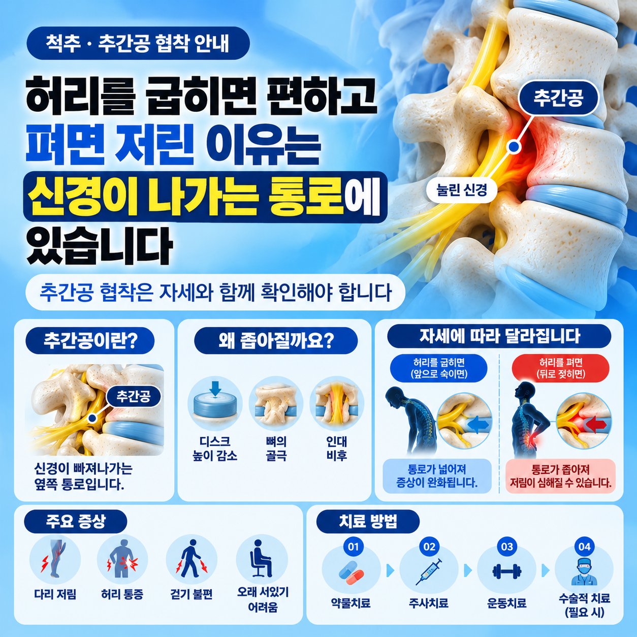 추간공협착