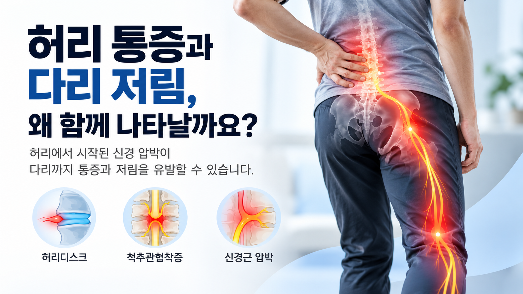 허리통증