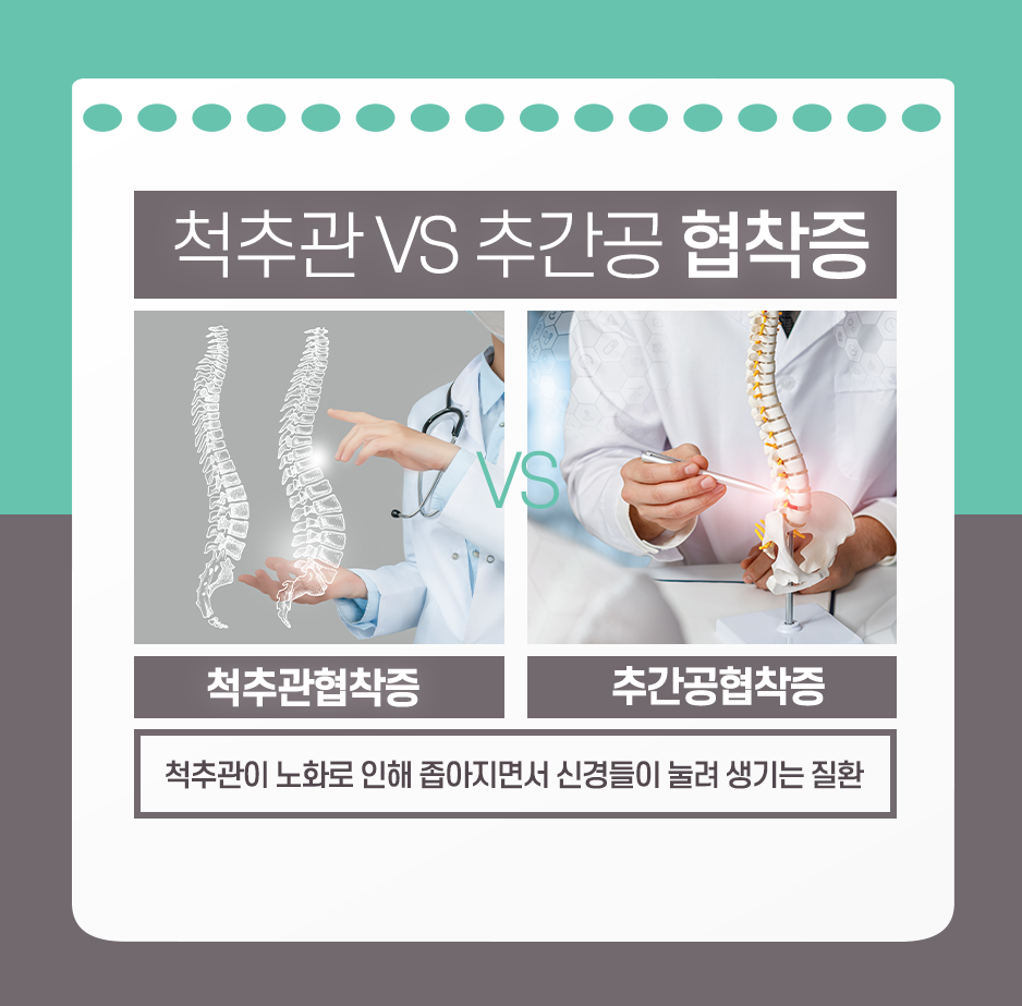 회전근개, 손상, 전주, 전주우리병원, 우리병원, 신경외과, 전주신경외과, 디스크, 허리디스크, 목디스크, 측만증, 협착증