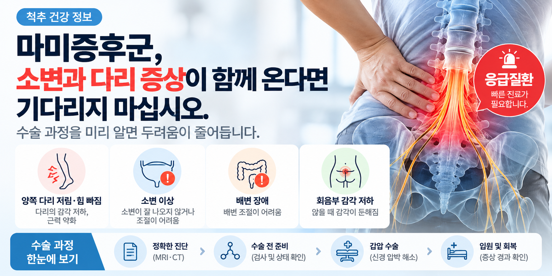 마미증후군