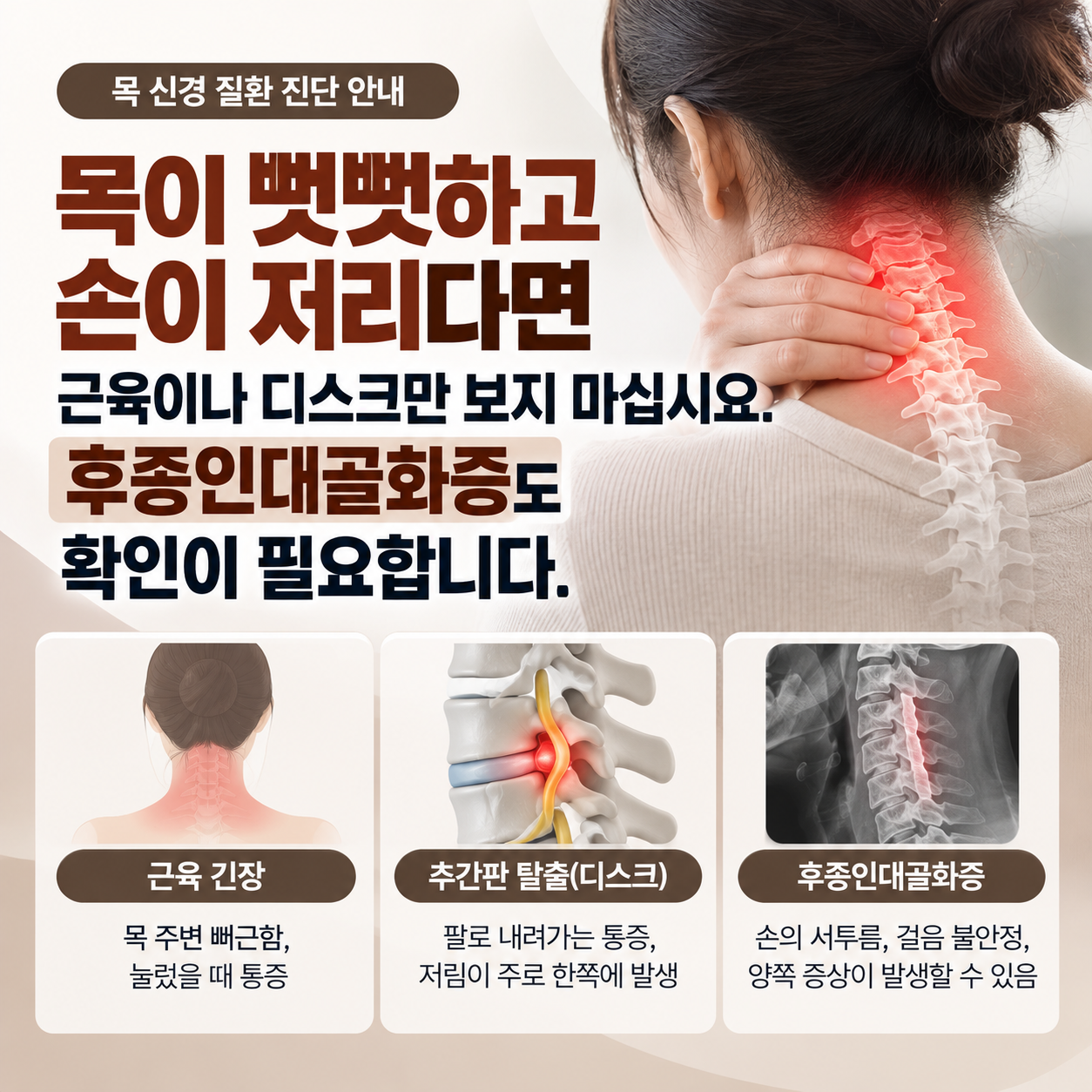 후종인대골화증