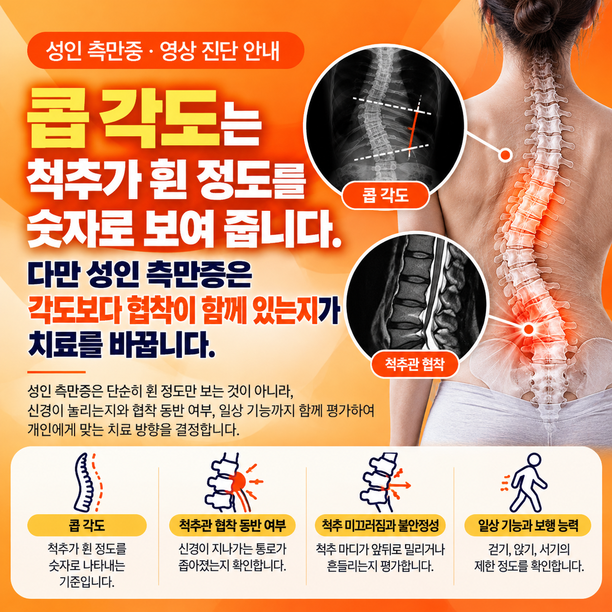 콥각도